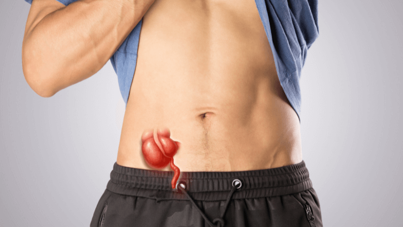 Appendicitis Treatment