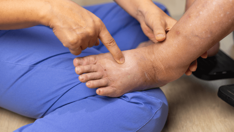 Hand and Foot Ankle Treatment