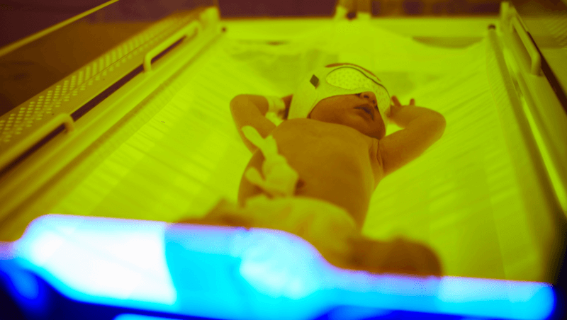 newborn-jaundice-treatment-in-bhugaon-bavdhan