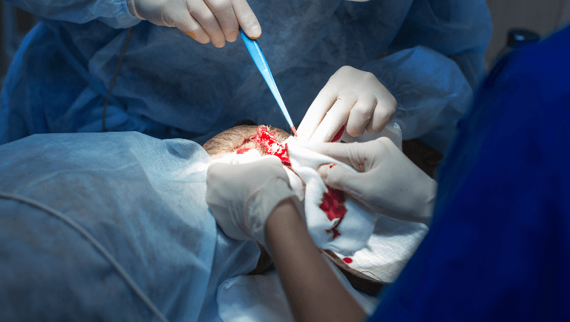 lasercircumcisionservice