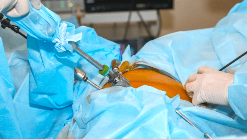 Laparoscopic-services
